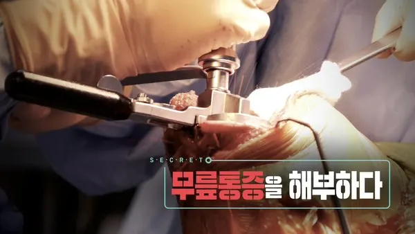 생로병사의 비밀 (사진=KBS)