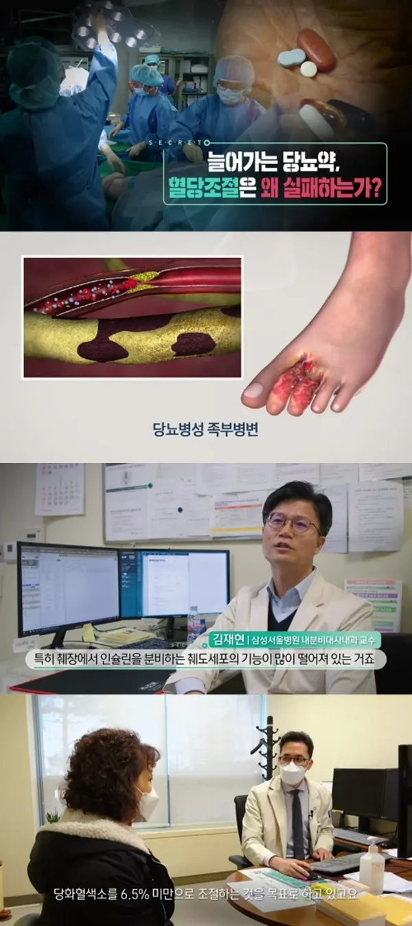 '생로병사의 비밀' 당뇨합병증·당뇨병성 족부병변 발생 원인은?(사진=KBS1)