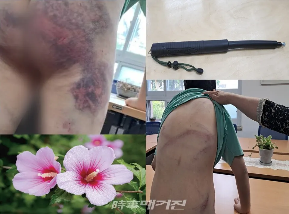 폭행에 사용한 '쇠 둔기'와 성한데 없는 발달장애 학생의 모습이 충격을 주고 있다. (사진_제보자 제공)