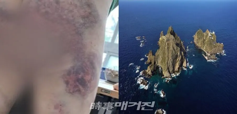 독도처럼 누구나 알지만, 무관심 속의 외로운 자신의 슬픔 감정을 '홀로아리랑'을 부르며 위로를 받고 있다.(사진_제보자/구글)