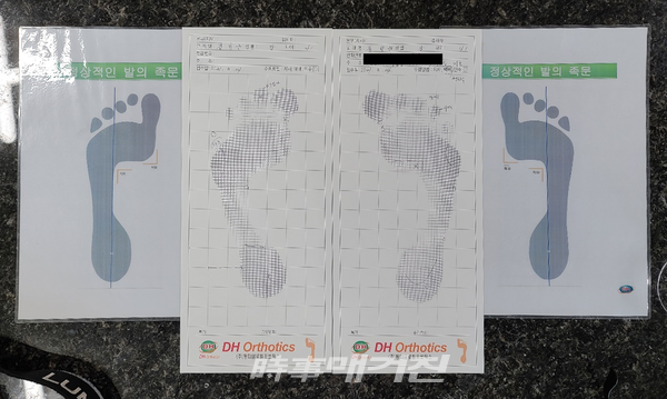 인터뷰 취재차 방문한 본 기자 역시 발 프린팅을 체험해 본 결과 정상적인 발의 족문에서 크게 벗어나 있음을 확인할 수 있었다.