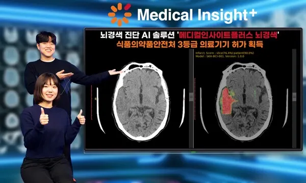 SK C&C가 뇌경색 진단 AI 솔루션 '메디컬인사이트플러스 뇌경색'이 식품의약안전처로부터 3등급 의료기기 품목 허가를 받았다고 22일 밝혔다. (사진_SK C&C)