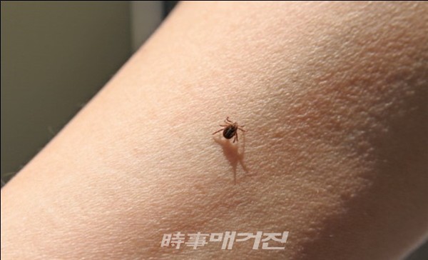 진드기에 물린 것으로 추정되는 상처가 있고 고열, 구토, 설사, 혈소판 감소, 림프절종대 등 증상이 나타나면 즉시 병원에서 치료를 받아야 한다.(사진_참진드기-SFTS)