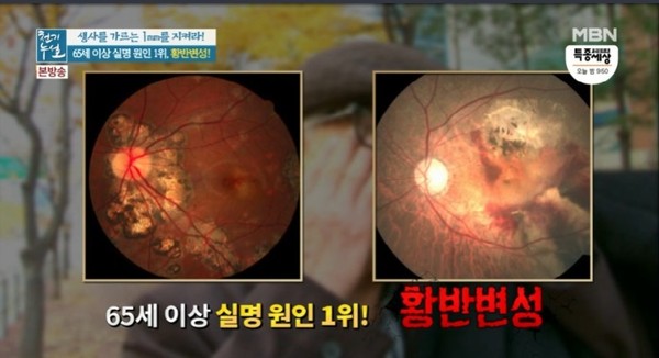 사진_mbn 천기누설 방송화면 캡쳐